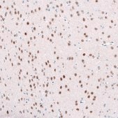 Monoclonal Anti-TCF7L2 antibody produced in mouse Prestige Antibodies® Powered by Atlas Antibodies, clone CL11547, purified antibody (Protein A)