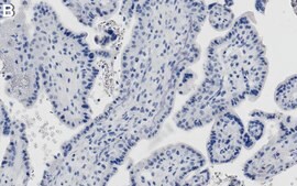 Anti-ATF6α Antibody, clone 1F11 ZooMAb® Rabbit Monoclonal recombinant, expressed in HEK 293 cells