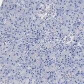 Anti-PLP1 antibody produced in rabbit Prestige Antibodies® Powered by Atlas Antibodies, affinity isolated antibody, buffered aqueous glycerol solution