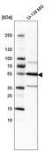Anti-IL1R1 antibody produced in rabbit Prestige Antibodies® Powered by Atlas Antibodies, affinity isolated antibody, buffered aqueous glycerol solution