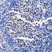 Anti-BRG1/SMARCA4 antibody produced in rabbit