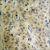 Anti-phospho-SYK (pTyr525) antibody produced in rabbit affinity isolated antibody