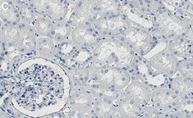 Anti-Aconitase 2/ACO2 Antibody, clone 1D15 ZooMAb® Rabbit Monoclonal recombinant, expressed in HEK 293 cells