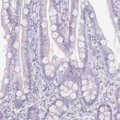 Anti-PAX5 antibody produced in rabbit Prestige Antibodies® Powered by Atlas Antibodies, affinity isolated antibody, buffered aqueous glycerol solution