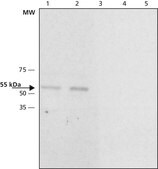 Anti-Calsequestrin-2 兔抗 ~1.0 mg/mL, affinity isolated antibody, buffered aqueous solution