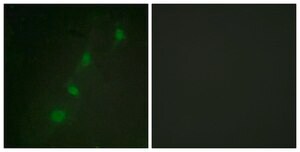 Anti-SGK antibody produced in rabbit affinity isolated antibody