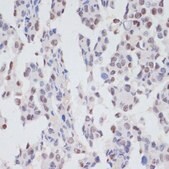 Anti-Phospho-SRF-S103 antibody produced in rabbit
