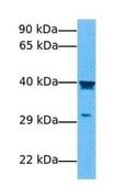 Anti-PCBP2 (AB1) antibody produced in rabbit IgG fraction of antiserum