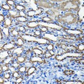 Anti- TTC11/FIS1 antibody produced in rabbit