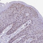 Anti-TGM3 antibody produced in rabbit Prestige Antibodies® Powered by Atlas Antibodies, affinity isolated antibody, buffered aqueous glycerol solution