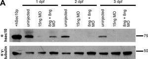 抗-γ-微管蛋白 兔抗 affinity isolated antibody, buffered aqueous solution