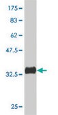 Monoclonal Anti-PAK4 antibody produced in mouse clone 3F10, purified immunoglobulin, buffered aqueous solution