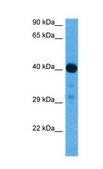 Anti-SMAD1 (AB2) antibody produced in rabbit IgG fraction of antiserum