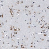 Anti-EIF2AK2 antibody produced in rabbit Prestige Antibodies® Powered by Atlas Antibodies, affinity isolated antibody, buffered aqueous glycerol solution