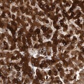 Anti-CRP antibody produced in rabbit Prestige Antibodies® Powered by Atlas Antibodies, affinity isolated antibody, buffered aqueous glycerol solution, Ab2