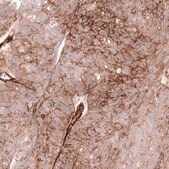 Anti-MCAM antibody produced in mouse Prestige Antibodies® Powered by Atlas Antibodies, clone CL12855, purified by using Protein A, buffered aqueous glycerol solution
