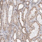 Anti-SGPL1 antibody produced in rabbit Prestige Antibodies® Powered by Atlas Antibodies, affinity isolated antibody, buffered aqueous glycerol solution, Ab2