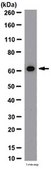 Anti-NFκB p65 Antibody, CT from rabbit