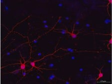 Milli-Mark® Pan Neuronal Marker Milli-Mark Pan Neuronal Marker is an antibody targeting the Pan Neuronal Marker protein, validated for use in ICC, IHC, IF &amp; IHC.
