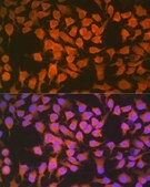 Anti-CBS antibody produced in rabbit