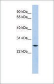 Anti-FTH1 affinity isolated antibody
