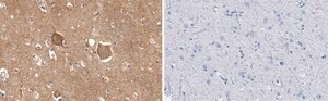 Anti-Trk-B Antibody, clone 2B22 ZooMAb® Rabbit Monoclonal recombinant, expressed in HEK 293 cells