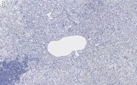 Anti-Dopamine β Hydroxylase Antibody, clone 2B11 ZooMAb® Rabbit Monoclonal recombinant, expressed in HEK 293 cells