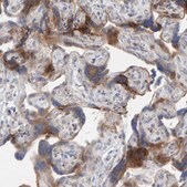 Anti-MMP16 antibody produced in rabbit Prestige Antibodies® Powered by Atlas Antibodies, affinity isolated antibody, buffered aqueous glycerol solution