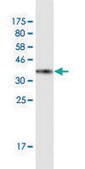 Monoclonal Anti-SUMO2 antibody produced in mouse clone 2H8, purified immunoglobulin, buffered aqueous solution