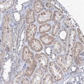 Anti-TMX2 antibody produced in rabbit Prestige Antibodies® Powered by Atlas Antibodies, affinity isolated antibody, buffered aqueous glycerol solution