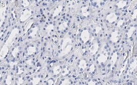 Anti-Bmi-1 Antibody, clone 1G8 ZooMAb® Rabbit Monoclonal recombinant, expressed in HEK 293 cells