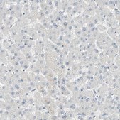 Anti-MUC1 antibody produced in rabbit Prestige Antibodies® Powered by Atlas Antibodies, affinity isolated antibody, buffered aqueous glycerol solution