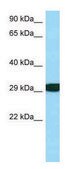Anti-RPS3 (C-terminal) antibody produced in rabbit affinity isolated antibody