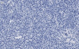 Anti-CFTR Antibody, clone 1C22 ZooMAb® Rabbit Monoclonal recombinant, expressed in HEK 293 cells