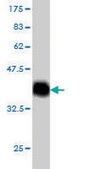 Monoclonal Anti-PIAS2 antibody produced in mouse clone 1F7, purified immunoglobulin, buffered aqueous solution