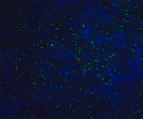 ORAI1单克隆抗体 小鼠抗 clone 3F6H5, purified immunoglobulin, buffered aqueous solution