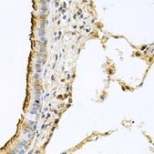 Anti-CD133 antibody produced in rabbit