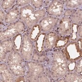 Anti-STAT3 antibody produced in rabbit Prestige Antibodies® Powered by Atlas Antibodies, affinity isolated antibody, buffered aqueous glycerol solution