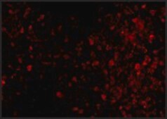 Anti-TRPC6 (ab1) antibody produced in rabbit affinity isolated antibody, buffered aqueous solution