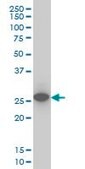 Monoclonal Anti-UCHL1 antibody produced in mouse clone 1B8-4D2, purified immunoglobulin, buffered aqueous solution