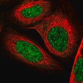 Anti-TAF8 antibody produced in rabbit Prestige Antibodies® Powered by Atlas Antibodies, affinity isolated antibody, buffered aqueous glycerol solution