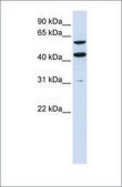 Anti-PTDSS1 antibody produced in rabbit affinity isolated antibody
