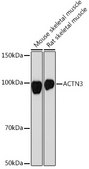 Anti-ACTN3 Antibody, clone 4H7E6, Rabbit Monoclonal