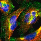Anti-PPFIBP1 antibody produced in rabbit Prestige Antibodies® Powered by Atlas Antibodies, affinity isolated antibody, buffered aqueous glycerol solution