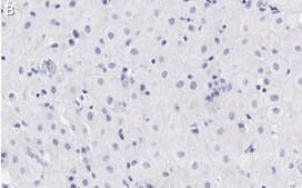 Anti-BMI-1 Antibody, clone F6 ZooMAb® Mouse Monoclonal recombinant, expressed in HEK 293 cells
