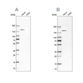 Anti-PLCG2 antibody produced in rabbit Prestige Antibodies® Powered by Atlas Antibodies, affinity isolated antibody, buffered aqueous glycerol solution, Ab2