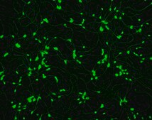 Human Spinal Motor Neurons Human iPSC line, Fully differentiated, Healthy Male Control (no known neurological disorders), Cryopreserved