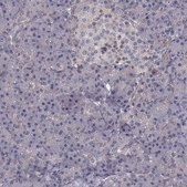 Anti-ITGB1 Prestige Antibodies® Powered by Atlas Antibodies, affinity isolated antibody