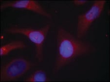 Anti-phospho-NFKBIA (pSer32/pSer36) antibody produced in rabbit affinity isolated antibody