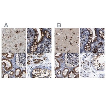 Anti-TGOLN2 antibody produced in rabbit Prestige Antibodies® Powered by Atlas Antibodies, affinity isolated antibody, buffered aqueous glycerol solution